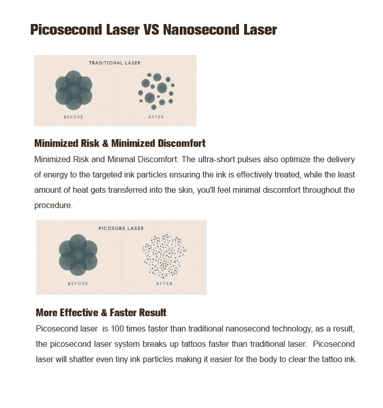 Laser Freckle Removal Permanent Adm Pigmentation Therapy Ce ND YAG Picosecond Laser Machine