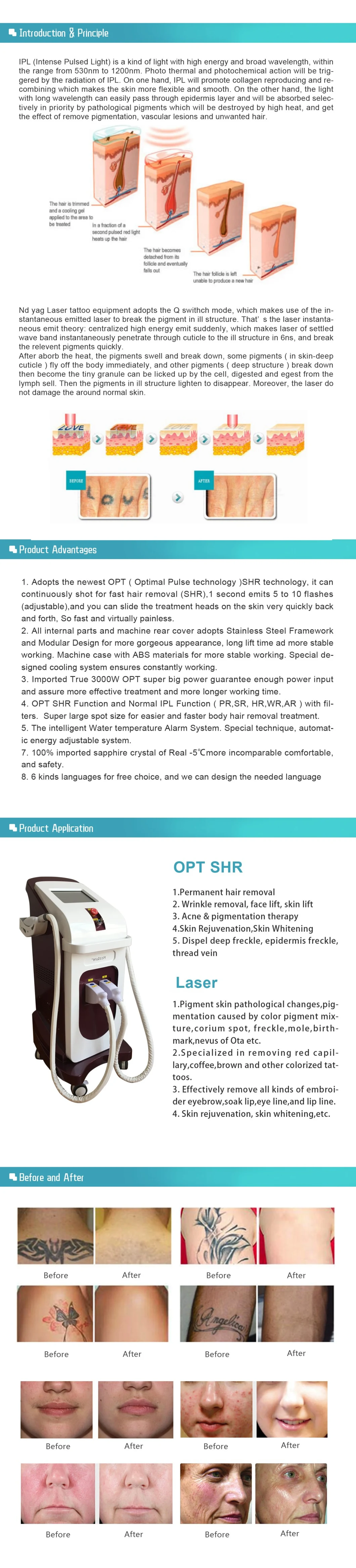 Salon Use 2 Handles IPL+Opt+ND YAG Laser for Tattoo Removal Hair Removal