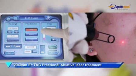 1064 Laser medico per depilazione a impulso lungo Approvato CE 8 in 1 Dispositivo laser multifunzione IPL RF Elight Q Switch ND YAG per depilazione e rimozione di tatuaggi